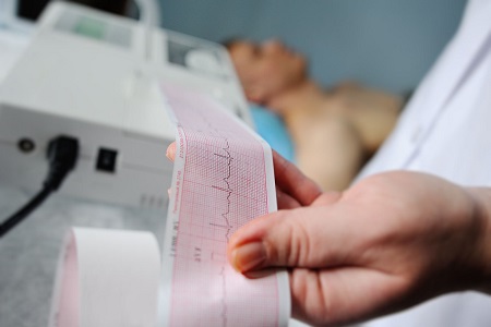 Electrocardiograma